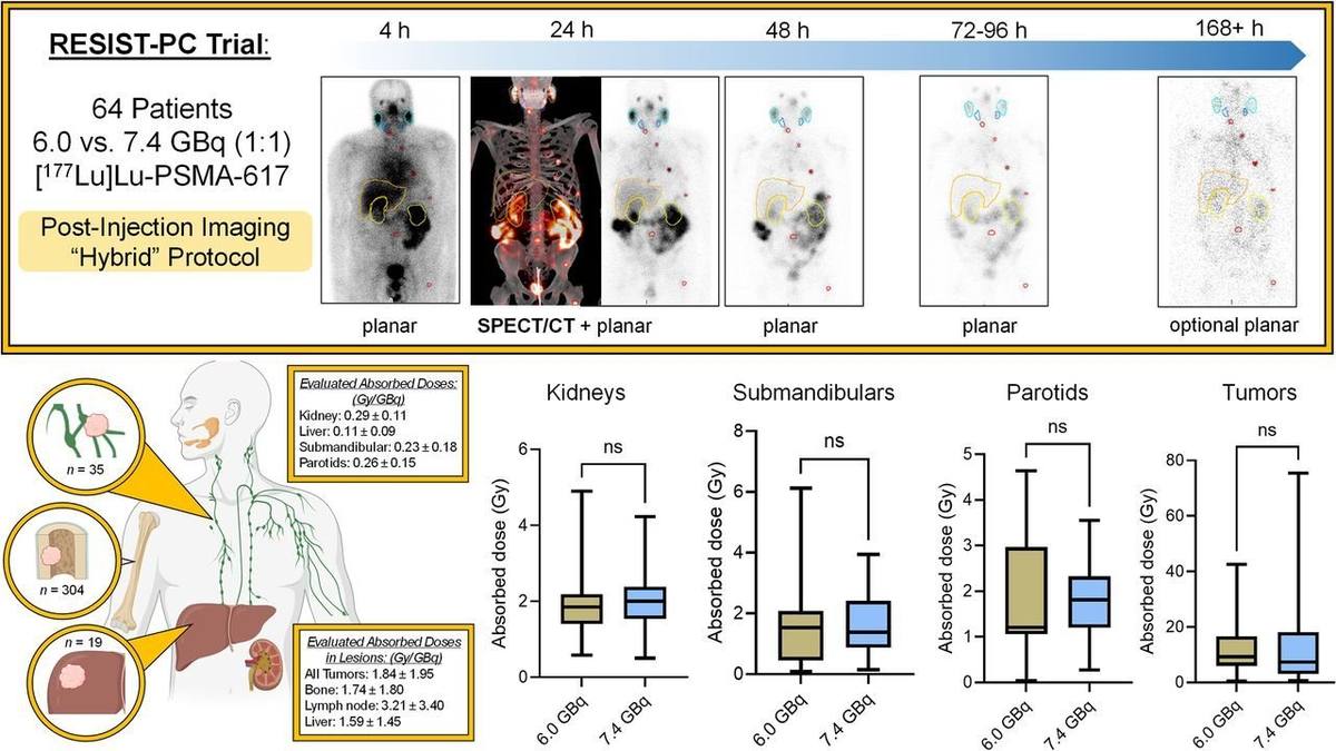 Tumor and Organ Dose Estimates from 177Lu-PSMA-617 Therapy in Patients with Metastatic Castration-Resistant Prostate Cancer: Results from the RESIST-PC Phase 2 Trial.的论文原文Figure 1