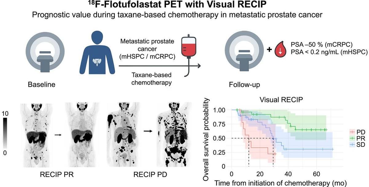 Prognostic Value of [18F]Flotufolastat PET Using Visual RECIP in Docetaxel-Treated Metastatic Prostate Cancer.的论文原文Figure 1
