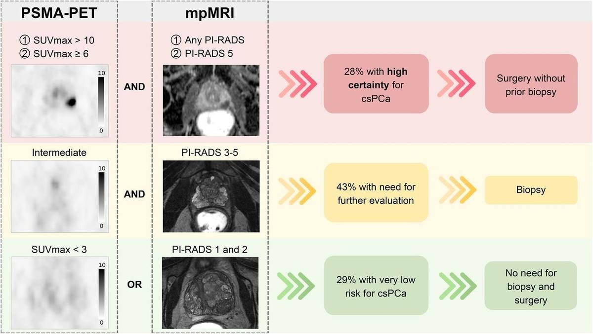 Toward a Biopsy-Free Diagnosis of Prostate Cancer: Potential of Combined 18F-Flotufolastat PSMA PET and mpMRI.的论文原文Figure 1