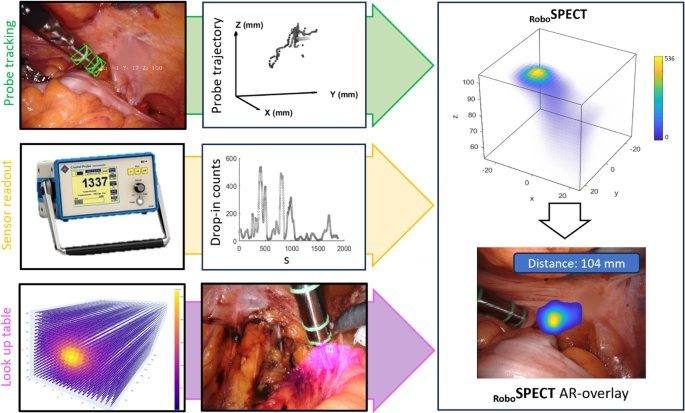 Redefining robotic image-guidance - tomographic visualization of lesions during prostate cancer surgery via gantry-free robotic SPECT.的原文研究流程或关键结果图