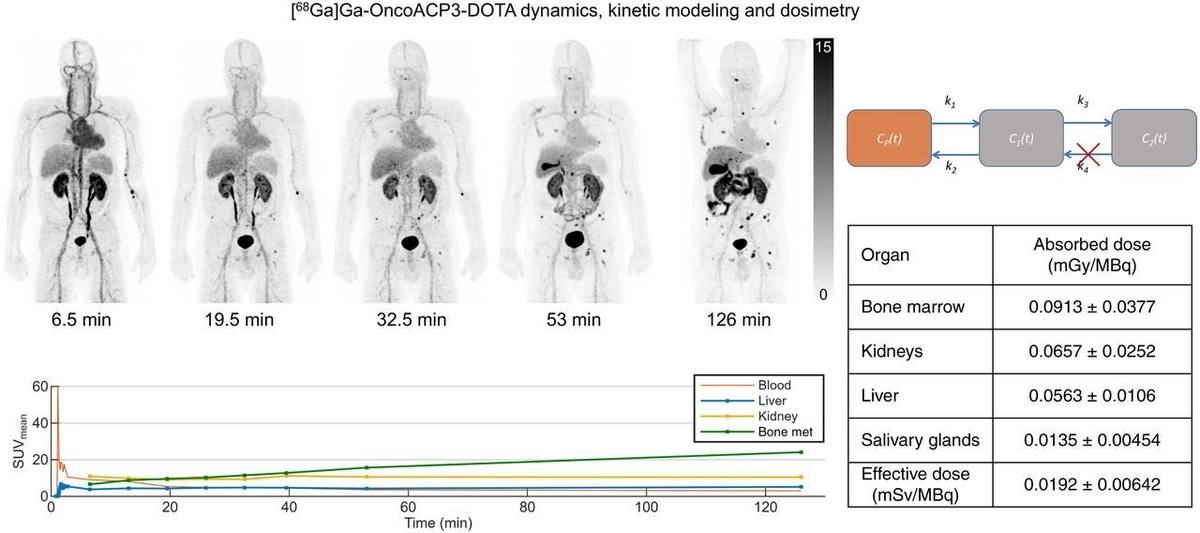 Dynamics,Pharmacokinetics,and Dosimetry of First-in-Human [68Ga]Ga-OncoACP3-DOTA PET in Patients with Prostate Cancer.的论文原文Figure 1