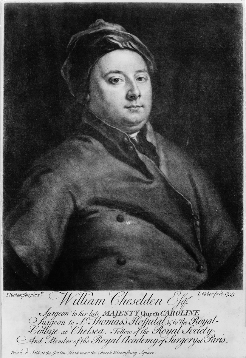 图12　William Cheselden肖像，他改良侧方会阴切石术，并按年龄汇总病例结局。
