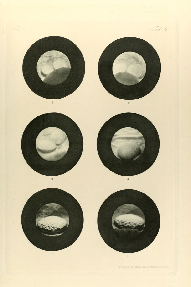 图20　Maximilian Nitze 1894年《Kystophotographischer Atlas》中的膀胱结石图版；六个圆形视野依次呈现早期膀胱镜下所见。