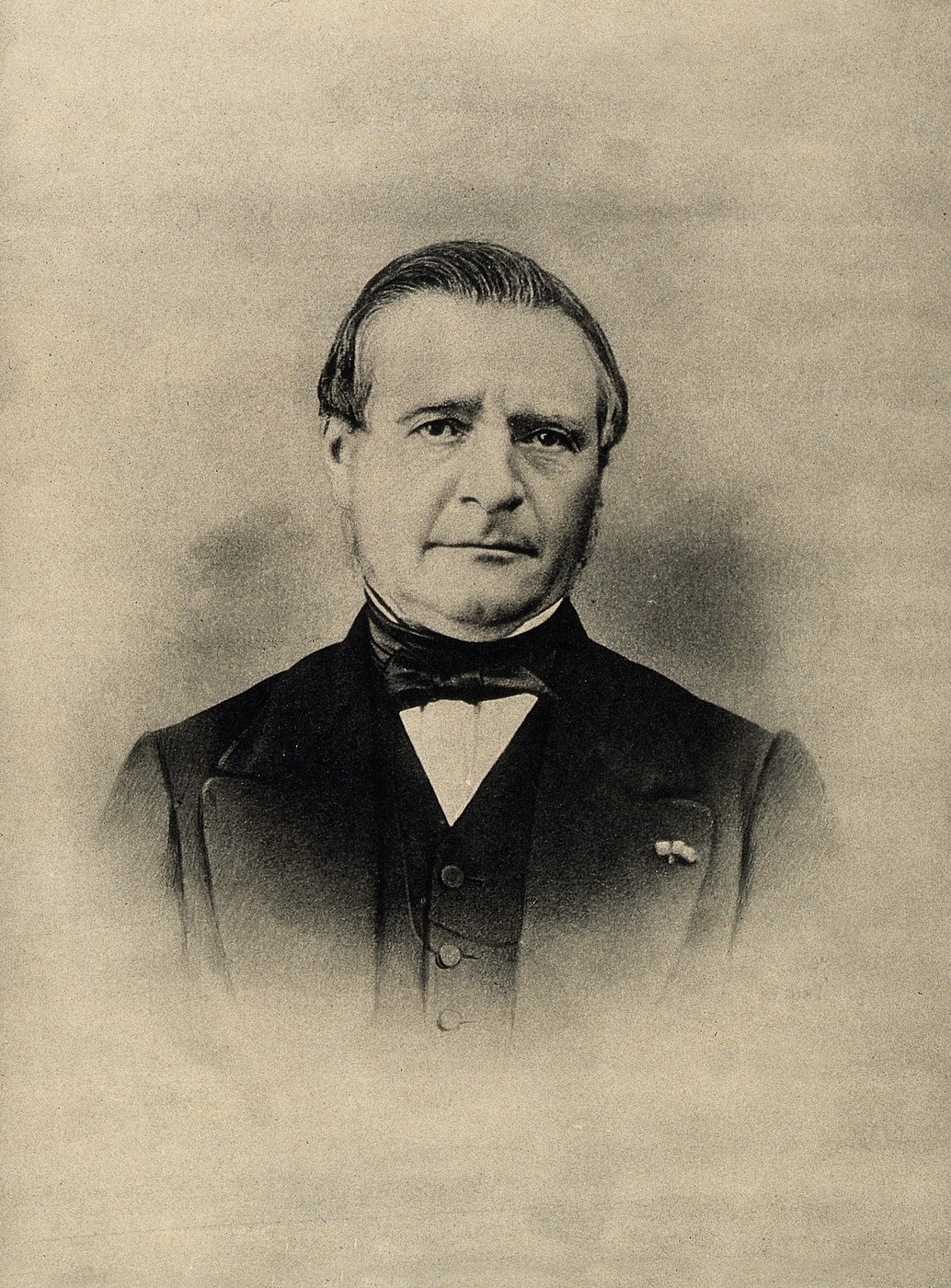图12 Louis-Auguste Mercier。他把导尿管尖端做成短小弯头，让器械不必用整根大弧度去应对前列腺部尿道。
